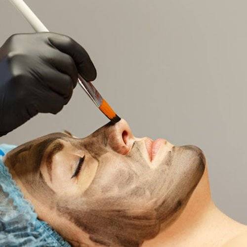 Hollywood Laser Peels newcastle