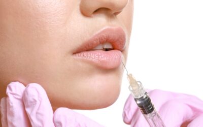 What to expect in your lip filler appointment