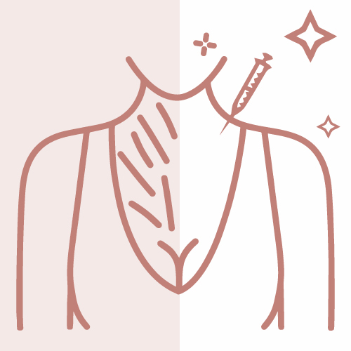 PRP-Neck Decolletage