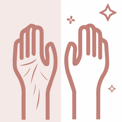 PRP for Hands