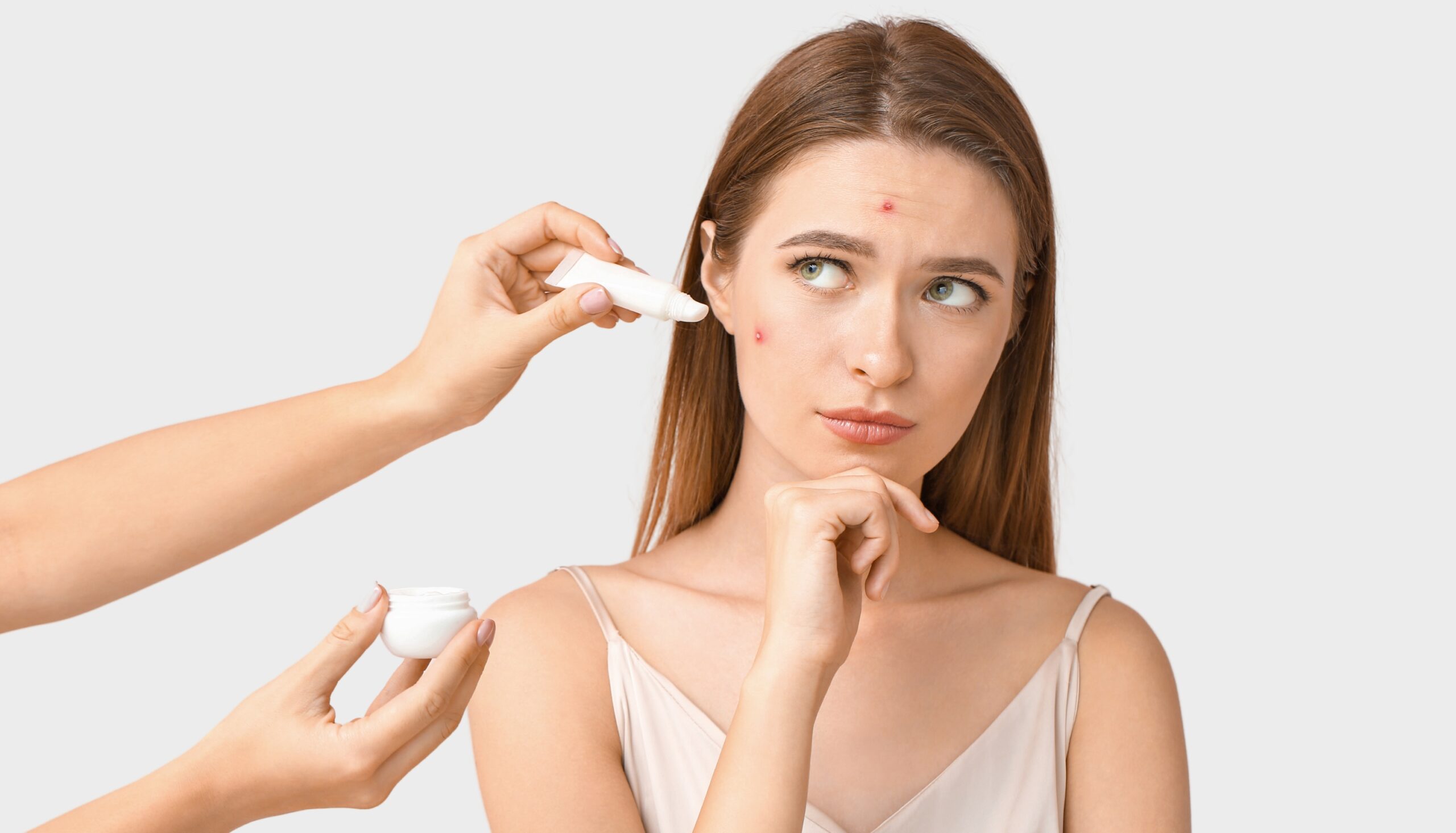 acne myths