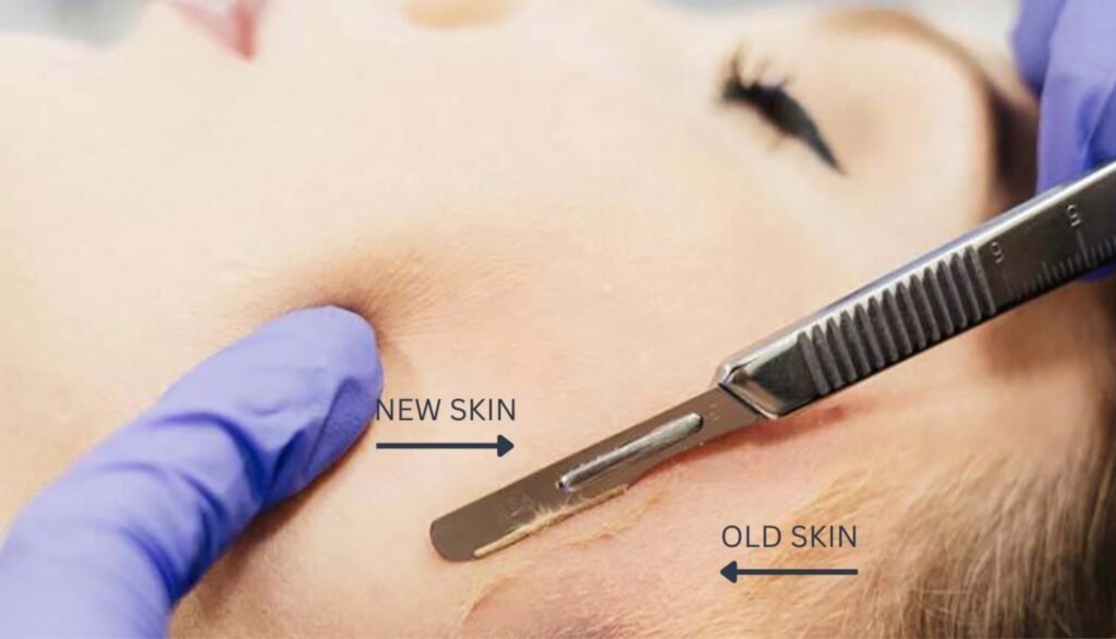 Dermaplaning Benefits - Smooth, Bright Skin - Skinduced