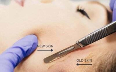Benefits of Dermaplaning and Dermablading