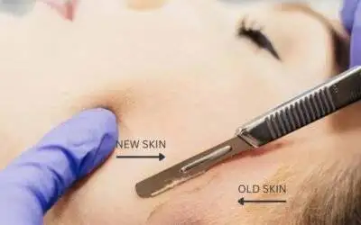 Benefits of Dermaplaning and Dermablading Complete Guide for 2025