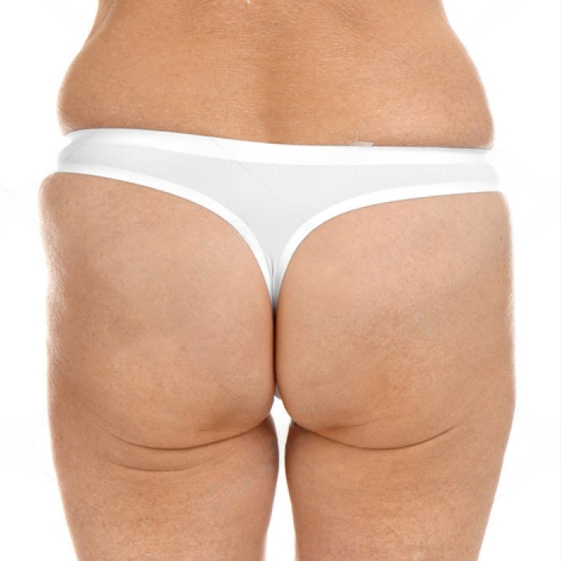 emsculpt buttocks 2 before