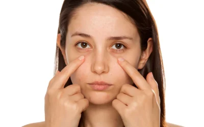 how to remove eye bags How to Remove Eye Bags Permanently?