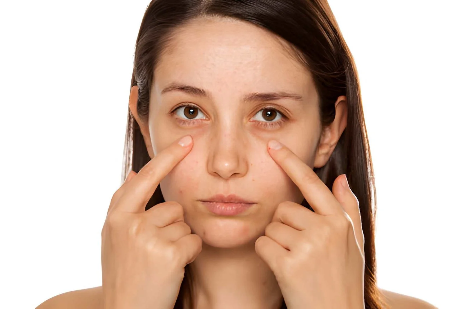 how-to-remove-eye-bags How to Remove Eye Bags Permanently