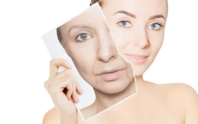 Fine Lines and Wrinkles Types, Cause ,Prevention and Treatment