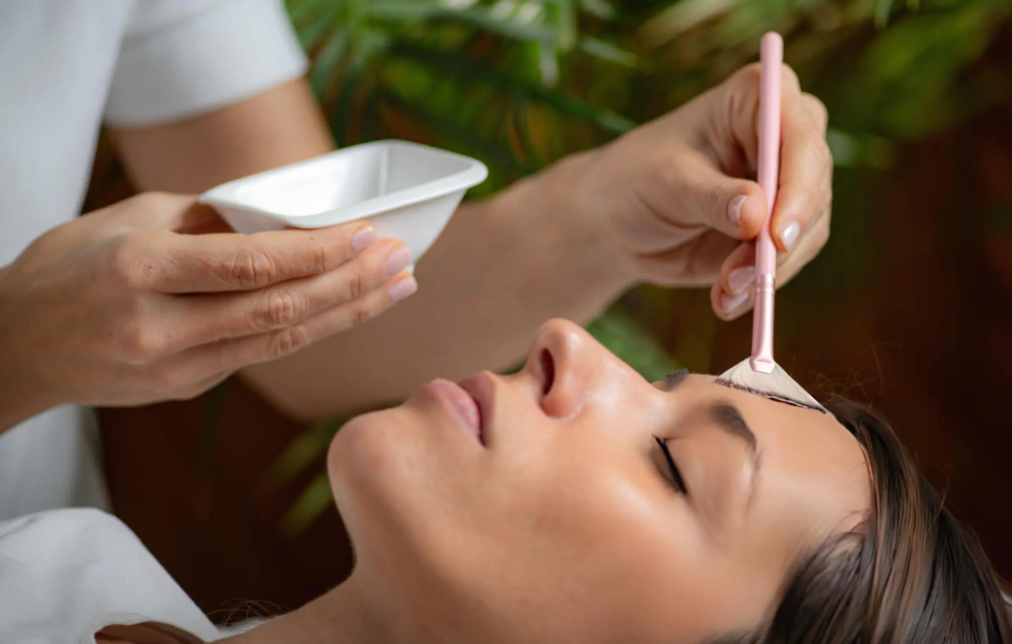 Chemical peels