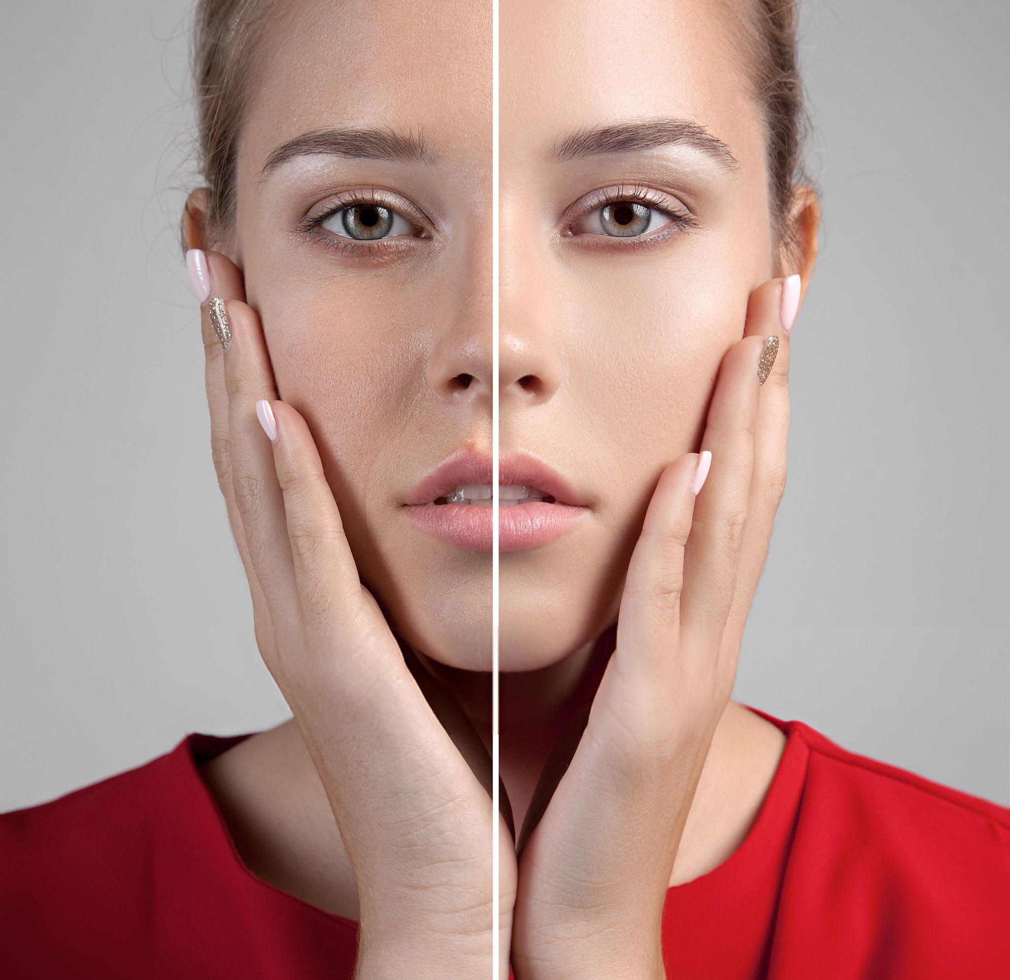 Skinduced Signature Facial 12