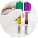 Platelet Rich Plasma5458352935