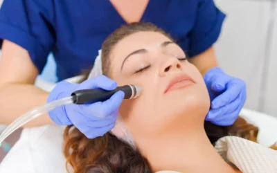 Tips for Caring Your Skin After Morpheus8 Treatment