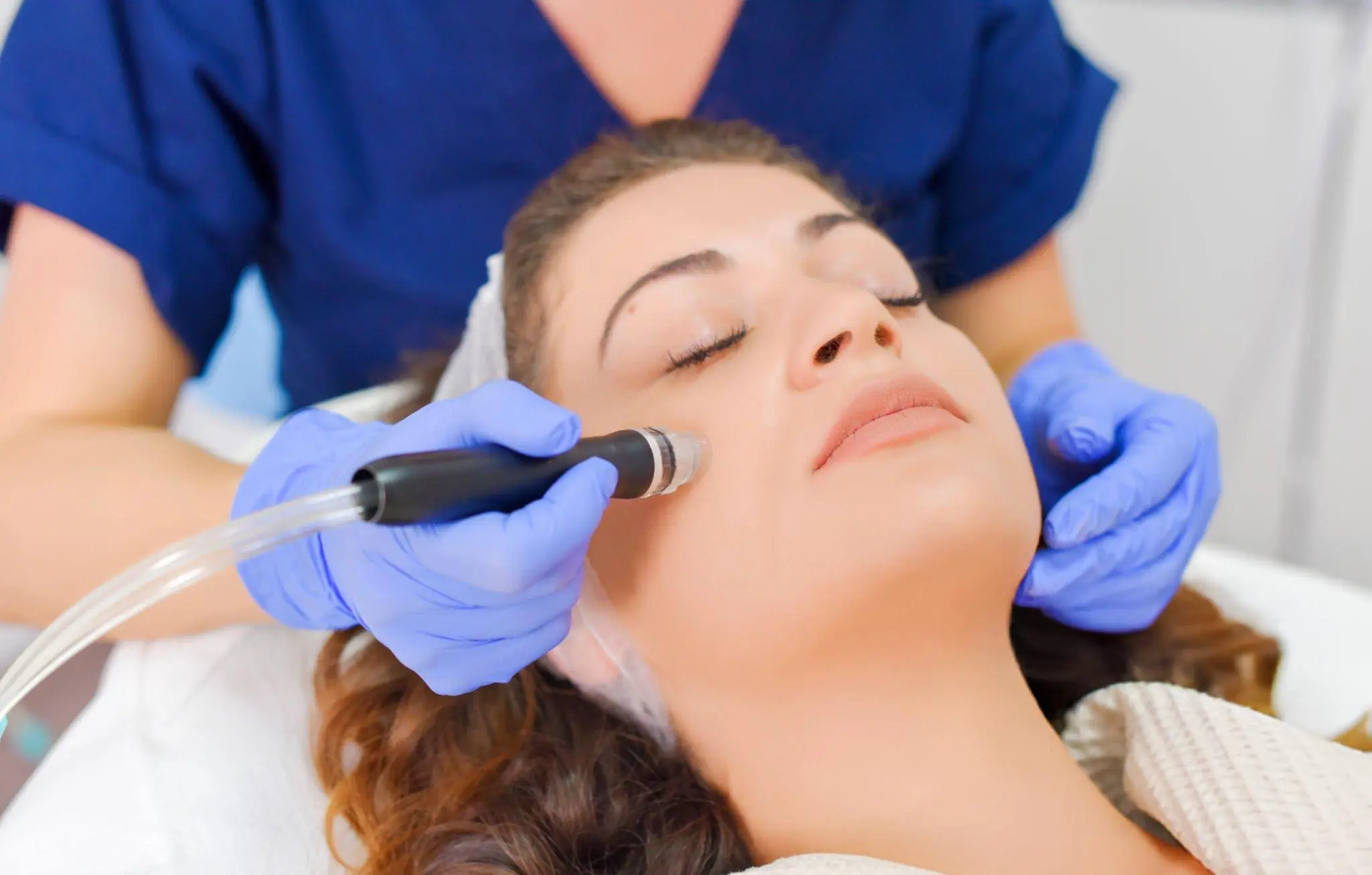 morpheus8 treatment