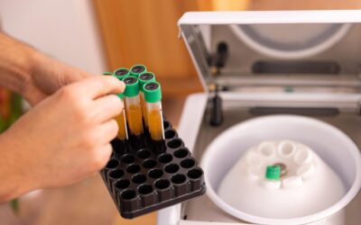 PRF vs PRP: What’s the Difference?
