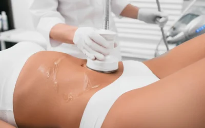 Is Fat Freezing Safe? Myths vs Facts About Cryolipolysis