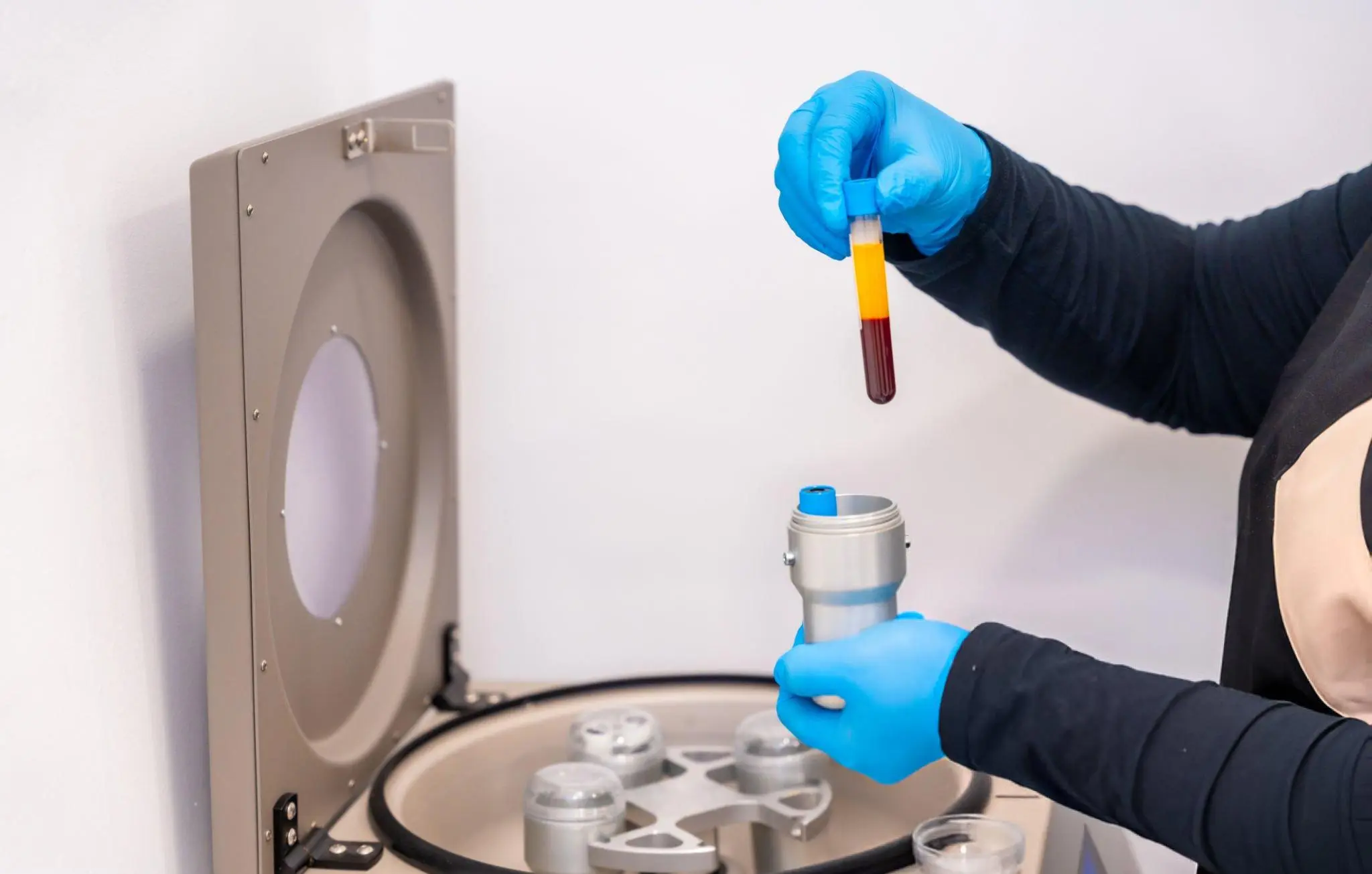 PRP Skin Rejuvenation