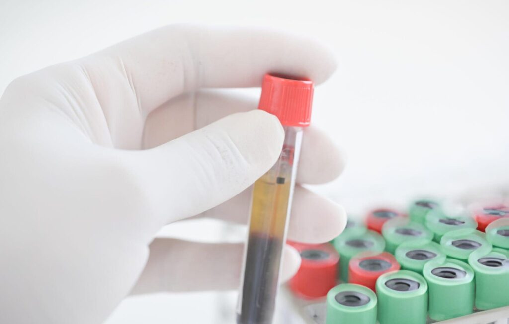 is prp safe for hair loss
