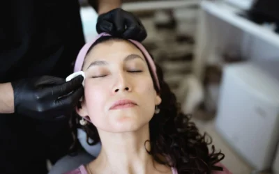 Microneedling with PRP in Newcastle – What to Expect & Who It Helps