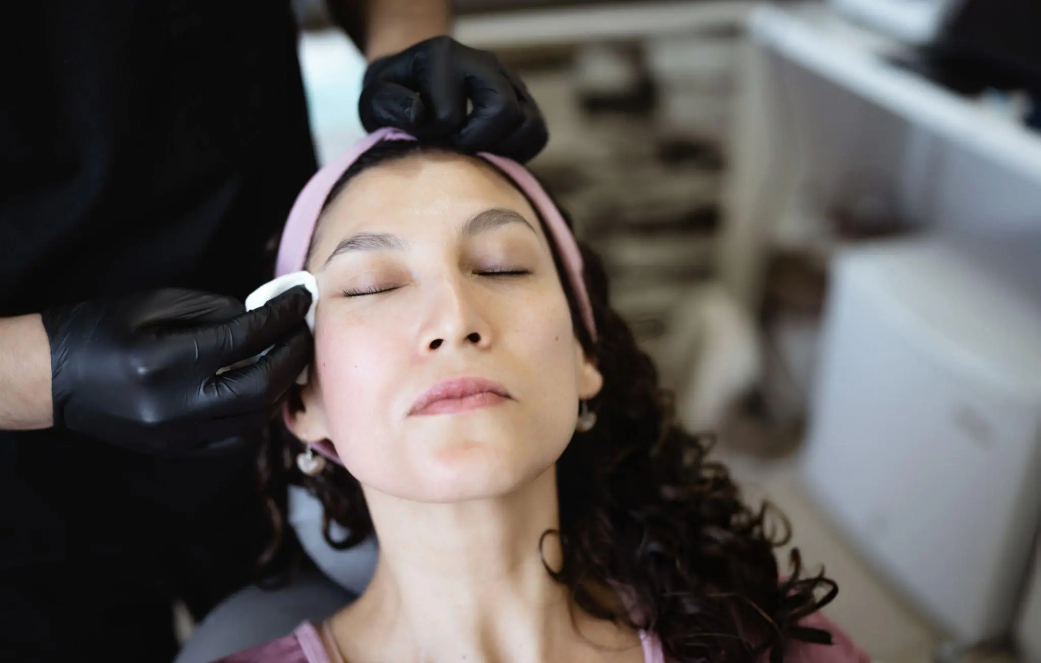 microneedling with prp