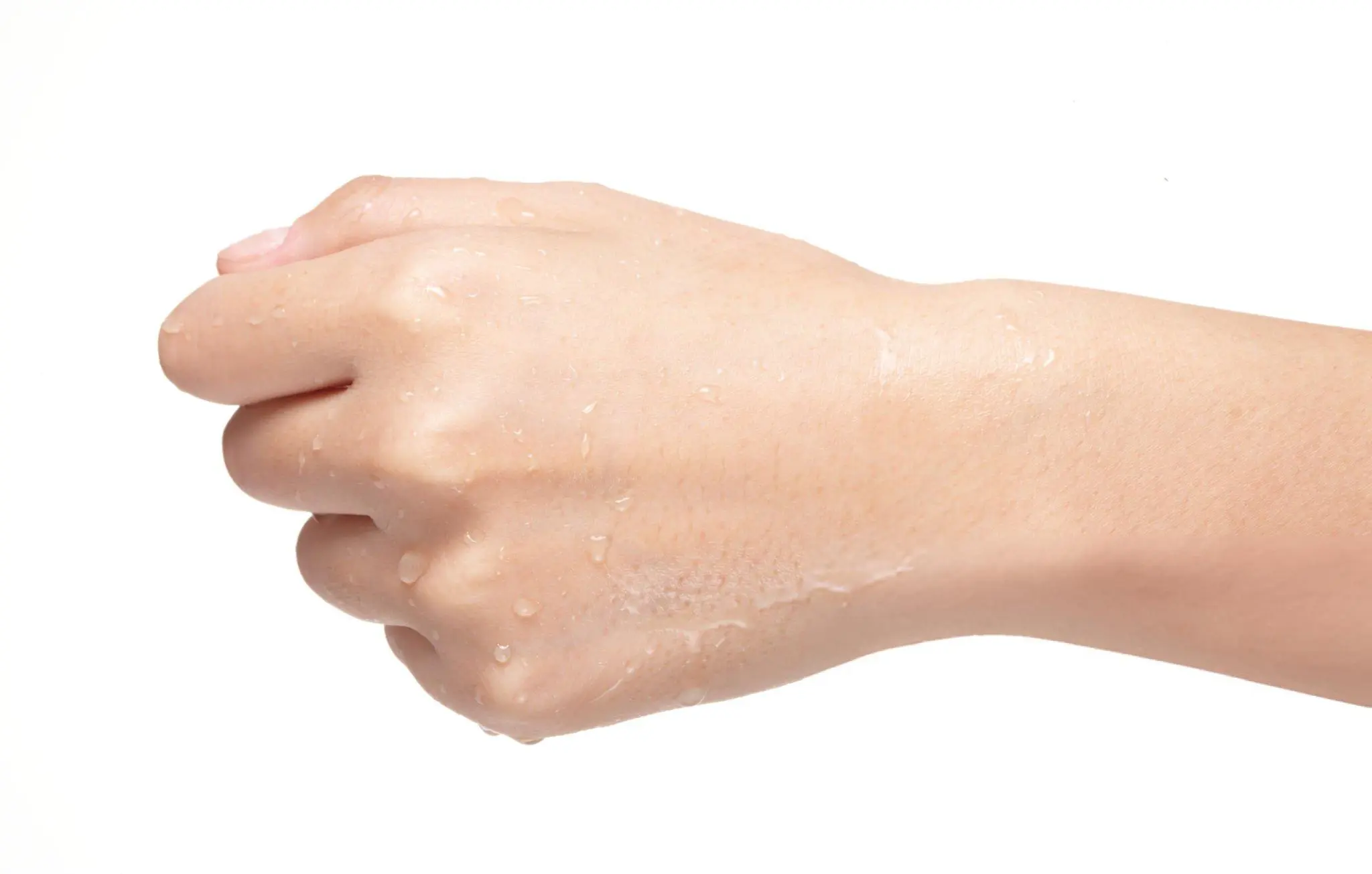 How to Stop Hyperhidrosis on Hands