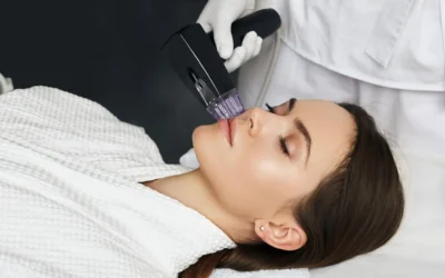 Morpheus Facial: How This Advanced Treatment Rejuvenates Your Skin