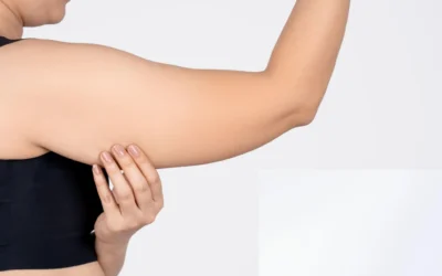 Fat Freezing Arms: Does It Really Work for Stubborn Arm Fat?