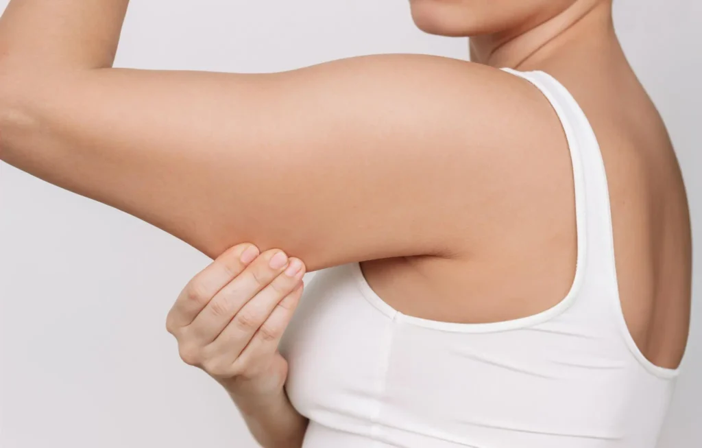 fat freezing arms teatment