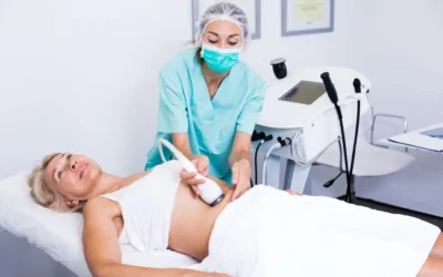 Fat Freezing Results: What to Expect After Cryolipolysis