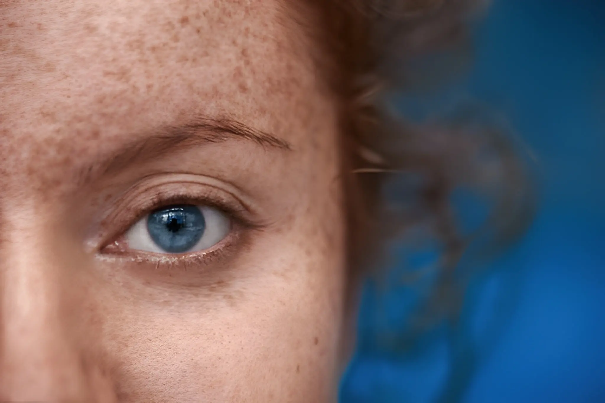 Dark Spots Removal Laser Treatment