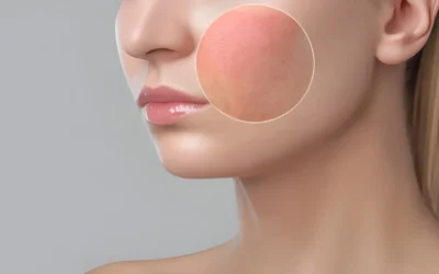 What Causes Large Pores and How to Get Smoother Skin