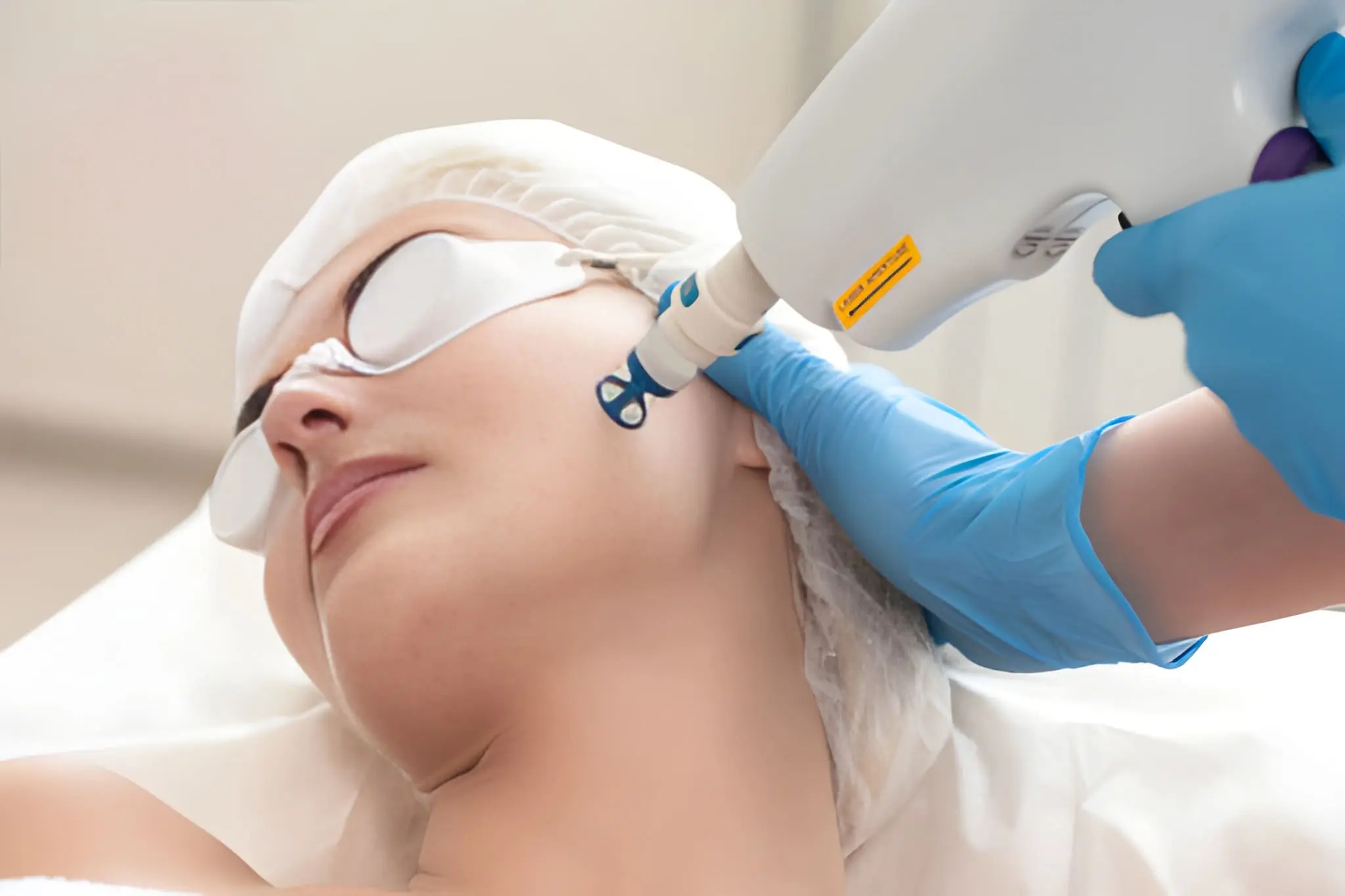Laser Treatment for Pigmentation