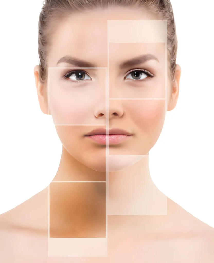 What Is Uneven Skin Tone What Is Uneven Skin Tone