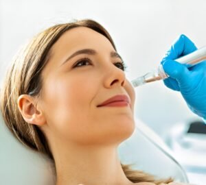 Vivace RF Microneedling