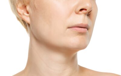 How to Get a Better Jawline How to Get a Better Jawline Without Surgery