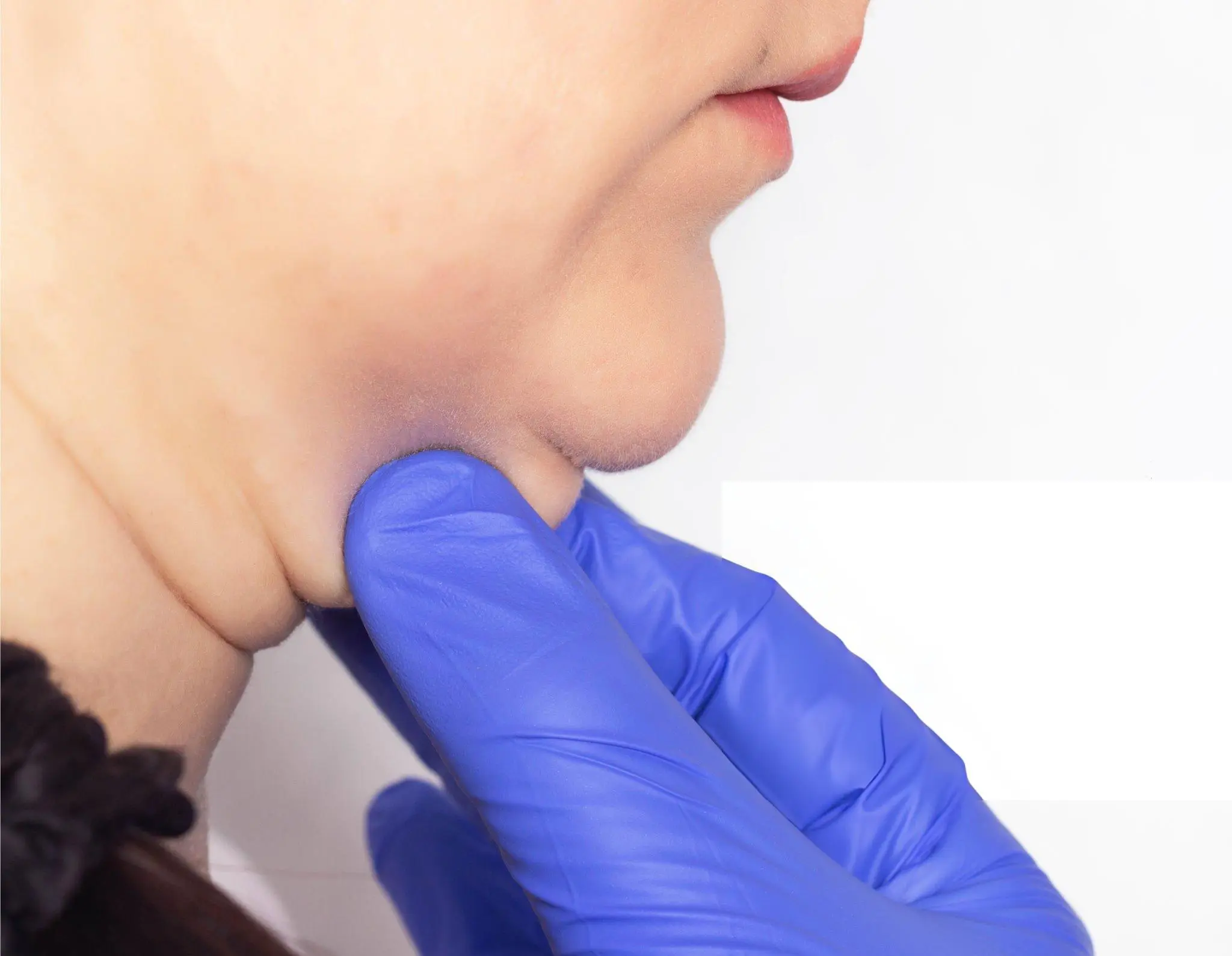 Chin Sculpting, Double Chin Treatment Options Chin Sculpting, Double Chin Treatment Options
