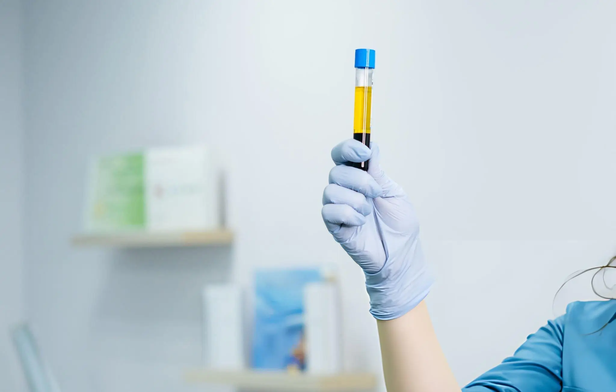 Cost for prp treatment Cost for prp treatment