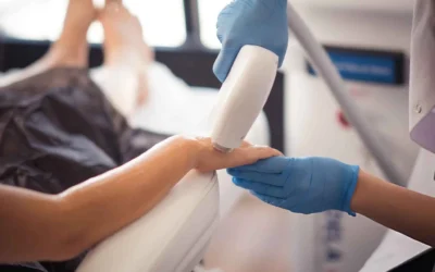 How Much Is Laser Hair Removal?