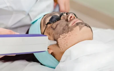 How Much Does Laser Pigmentation Removal Cost? A Complete Guide