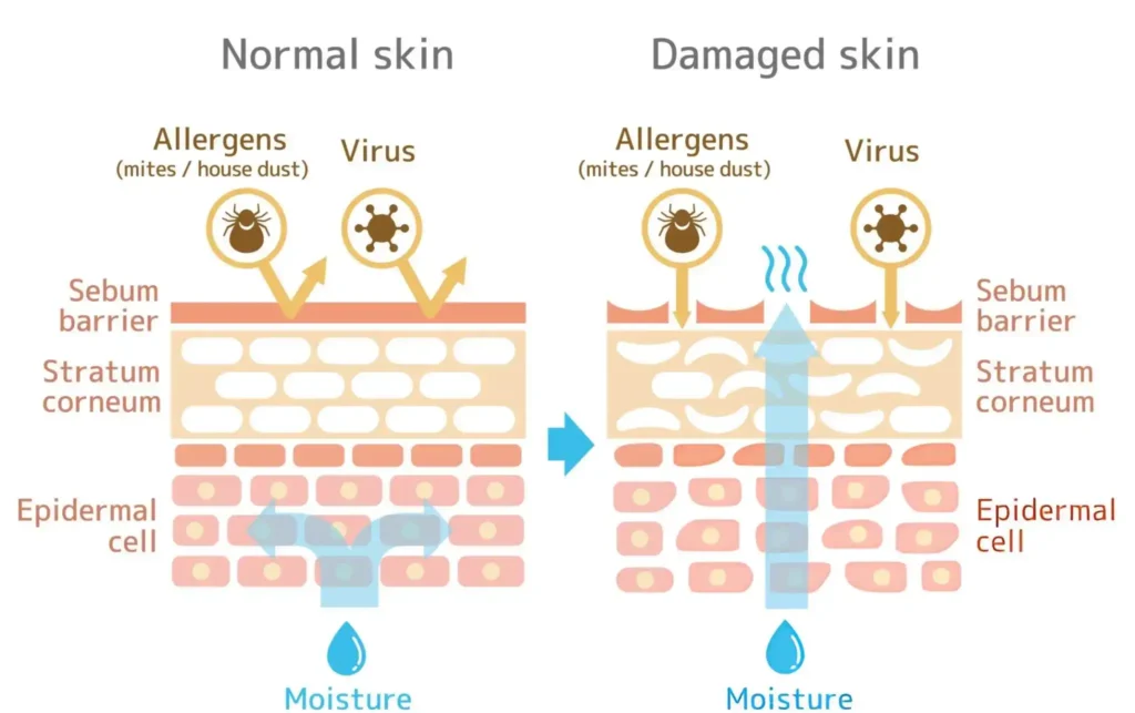 How to Fix Damaged Skin Barrier How to Fix Damaged Skin Barrier