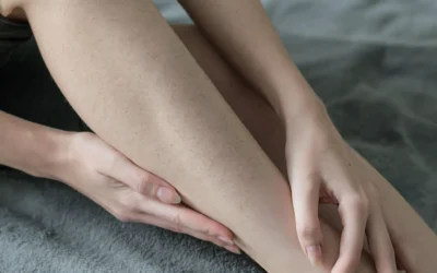 Strawberry Legs – Causes, Prevention and Treatment Options