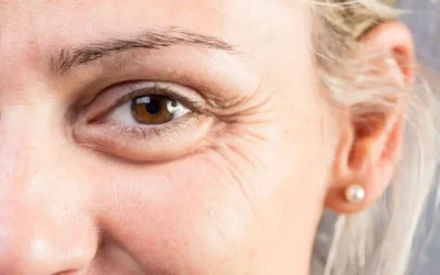 Crepey Skin Under Eyes What Causes Crepey Skin Under Eyes? Treatment Options Explained