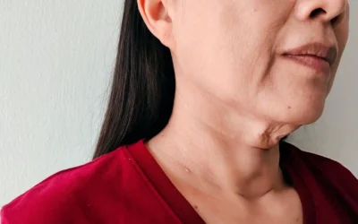 Crepey Skin Crepey Neck & Décolletage – How to Firm Ageing Skin