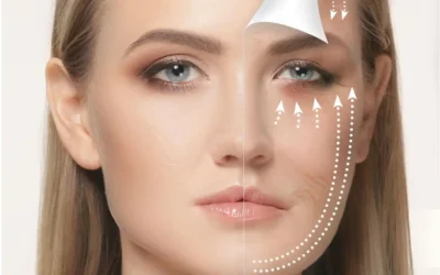 Menopause And Skin Laxity Menopause and Skin Laxity – Why Firmness Changes and What Helps
