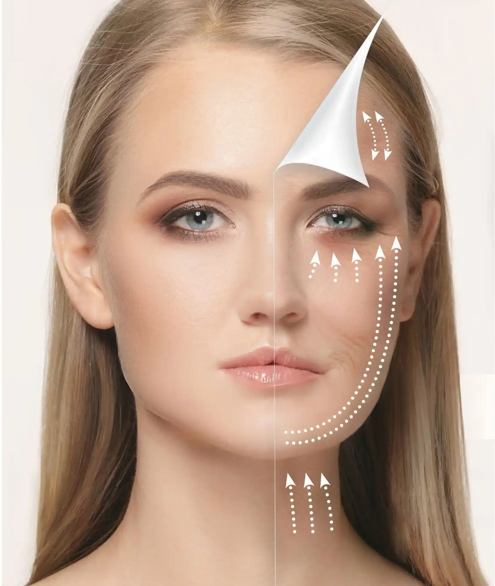 Menopause And Skin Laxity